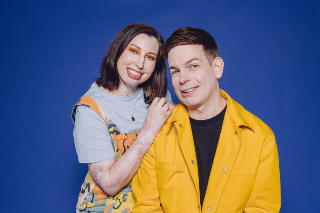Gary Parsons at Changing Faces UK Face Equality Week photoshoot 2026